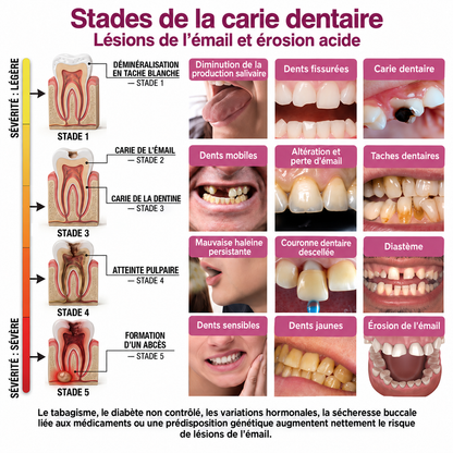 Glimmerly® 🍁💖DenPerm🎉— Gel Réparateur de l’Émail Naturel pour Caries, Dents Sensibles & Émail Fragilisé