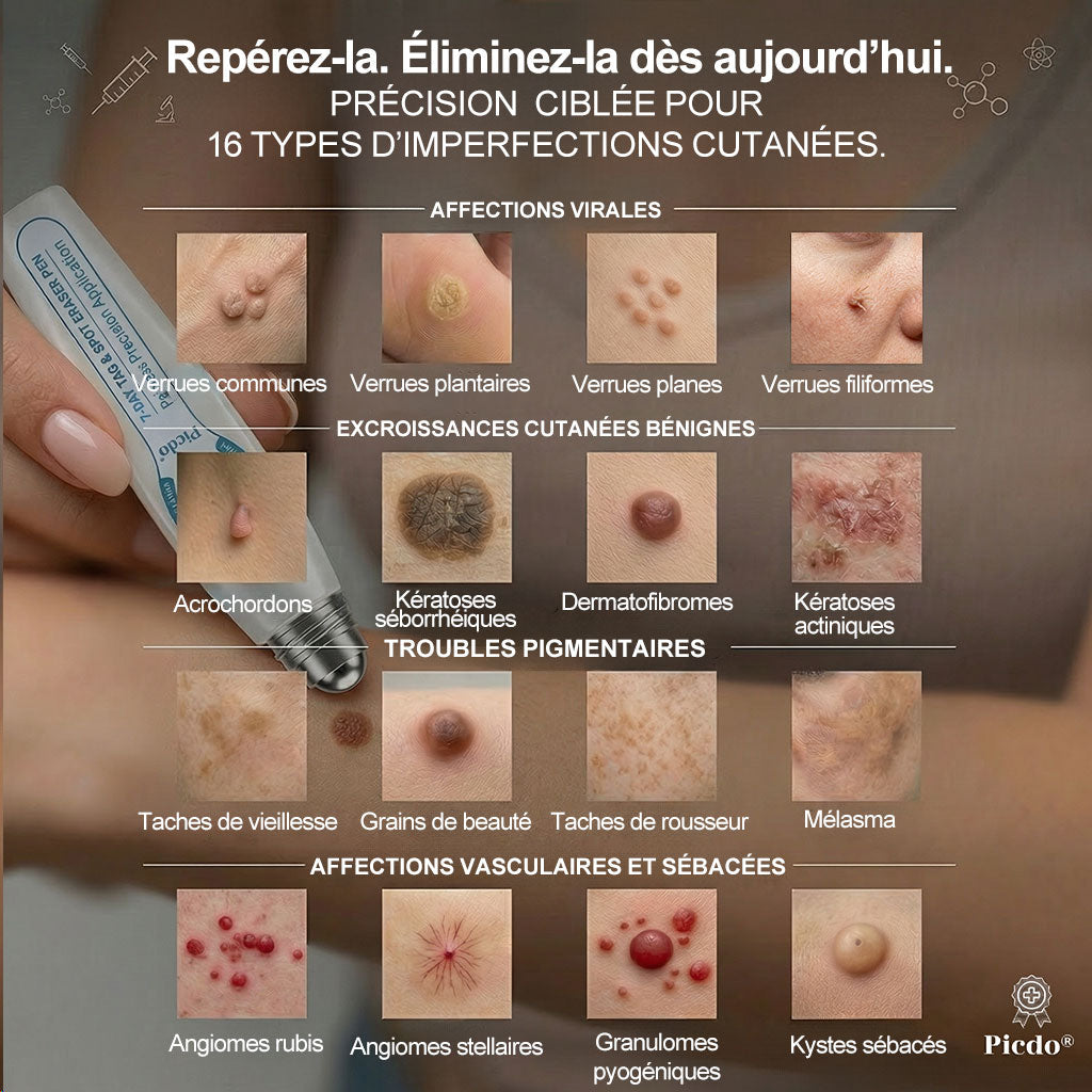 Boutique officielle de la marque 𝐏i𝐜𝐝o® 🍈💖7 Jours Effaceur de taches et d’excroissances cutanées(Zéro douleur, zéro cicatrice – Roller)